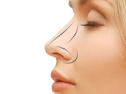 Say Goodbye to Insecurities: Rhinoplasty in Riyadh
