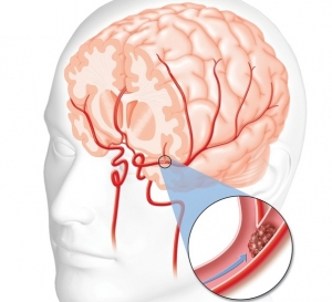 Enhancing Global Blood Brain Barrier Market with Nanotechnological Innovations