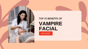 Vampire Facial