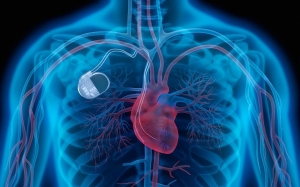 Cardiac Restoration Systems Market to Grow at 10% Owing Increasing Prevalence of Heart Diseases