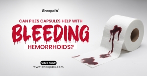 Can Piles Capsules cure permanently Bleeding Hemorrhoid? 