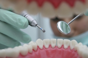 Global Dental Consumables Market: Growth Strategies & Key Drivers