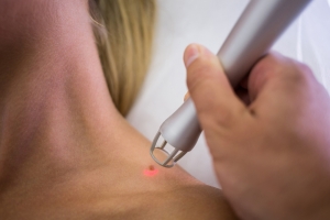 The Pros and Cons of Laser Tattoo Removal: Is It Worth It?