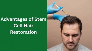 Advantages of Stem Cell Hair Restoration