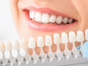 Porcelain vs. Composite Veneers: Pros and Cons