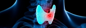 Regional Dynamics of the Hypoparathyroidism Market: Key Insights and Growth Prospects