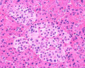Market Dynamics and Competitive Landscape of the Paraganglioma Market