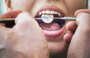 Caring for Your Retainer, Tips and Tricks