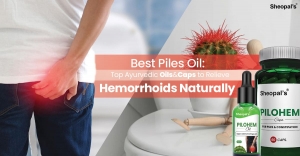 Best Piles Oil: Top Ayurvedic Oils to Relieve Hemorrhoids Naturally