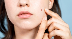 Male vs. Female Scar Removal Treatments in Islamabad – Are They Different?