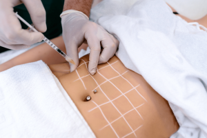 Fat Melting Injection in Dubai – Feel Lighter, Look Better