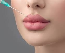 Russian Lip Fillers in Dubai: Recovery, Side Effects & Results