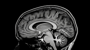 MRI Near Me: Finding the Best Imaging Center for Accurate Diagnosis