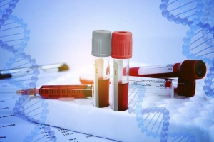 Trends and opportunities in the U.S. Hemophilia Treatment Market will drive growth owing to rising healthcare expenditure
