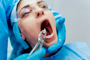 Is Dental Extraction Necessary | Common Reasons & Solutions