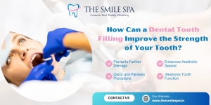 How Can a Dental Tooth Filling Improve the Strength of Your Tooth?