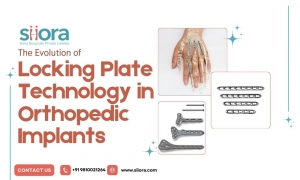 The Evolution of Locking Plate Technology in Orthopedic Implants