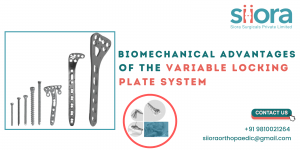 Biomechanical Advantages of the Variable Locking Plate System