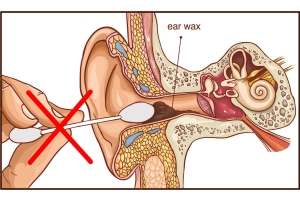 Safely Clean Your Ears: Avoid Damage and Stay Healthy!