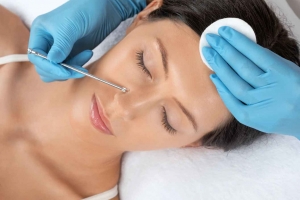 Top Blackhead Treatment Dermatologist Solutions for Stubborn Pores