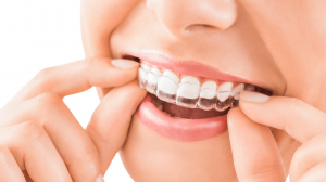 The Best Dentist in Turkey: Your Guide to World-Class Dental Care