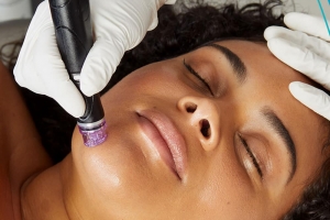 Say Goodbye to Dull Skin – Hello HydraFacial!