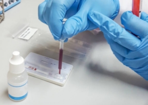 Rapid Influenza Diagnostic Tests Market Growth Driven by Rising Demand for Quick and Accurate Diagnostic Solutions