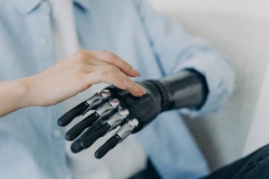 Robotic Prosthetics Market Exhibits Exponential Growth Due to Advanced AI Integration in Healthcare Solutions