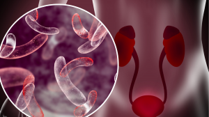 Challenges in the Uncomplicated Urinary Tract Infection Market