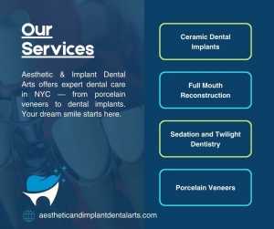 What Are Porcelain Veneers? A Complete Guide