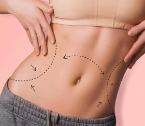 Liposuction That Turns Your Vision Into Reality