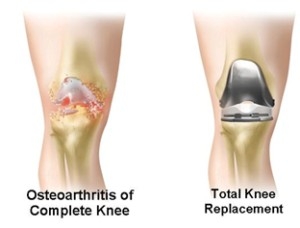 Exploring World-Class Orthopedic Treatments at the Best Orthopedic Hospital in Hyderabad