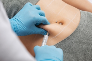 Smooth out your shape using Fat Melting Injections