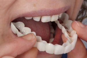Protect Your Teeth, Why Everyone Should Consider a Mouthguard