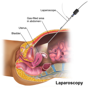 Find the Best Laparoscopic Surgeon in Riyadh