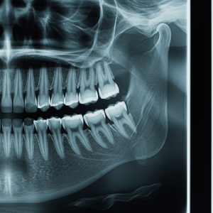 North America Dental X-Ray Market Growth, Opportunities, and Regional Forecast To 2027