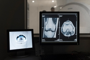 5 Vital Parameters to Consider a Perfect Radiology Billing Company 