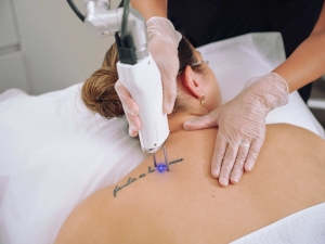 Your skin deserves a second chance — try laser tattoo removal