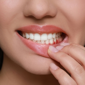 Hole in Your Gum? 5 Possible Reasons and How to Fix It