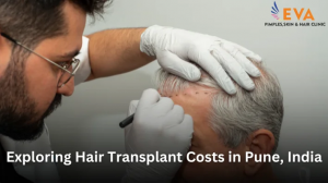 Hair Transplant in Pune Explained: Methods, Recovery, and Outcomes