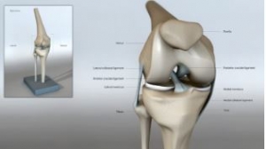 Types of Fracture Surgery and What to Expect Afterward