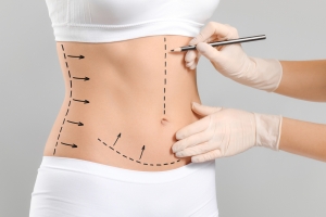 Liposuction: Slim, Snatch, and Shine Like Never Before