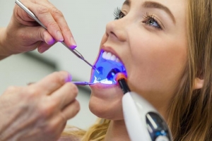 How Zoom Whitening Affects Your Enamel: Fact vs Fiction