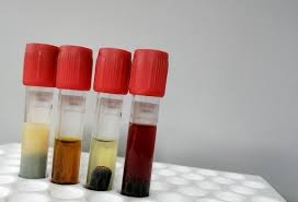 Using Human Serum Samples to Improve Diagnostic Accuracy