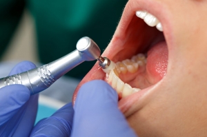 Preventing Stains Before They Happen: Your Guide to Healthy, White Teeth