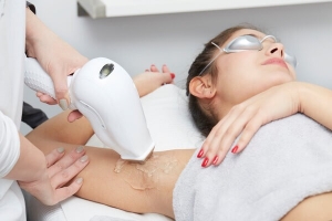 Clean Skin Starts with Laser Sessions