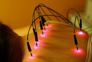 Acupuncture Lasers Market | Merging Traditional Therapy with Modern Innovation