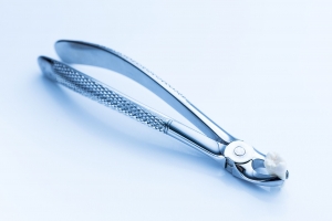 Tooth Extraction Made Easy: A Complete Patient Guide - KAA Dentals