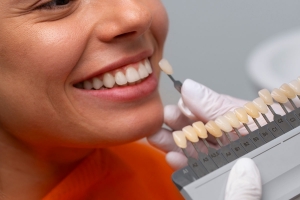 The Science Behind Dental Veneers: Materials, Process, and Innovation
