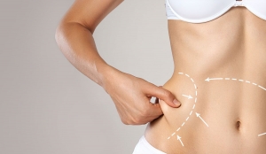 Snatch Your Waist and Contour Your Hips with Liposuction